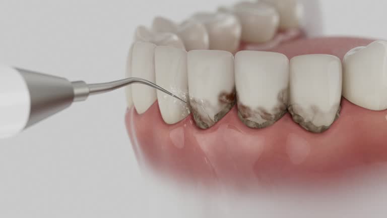 Reliable Dental contractor in Whetstone, AZ by Smile Center Dentistry